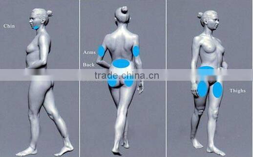 CE approved ultrasound cavitation slimming machine