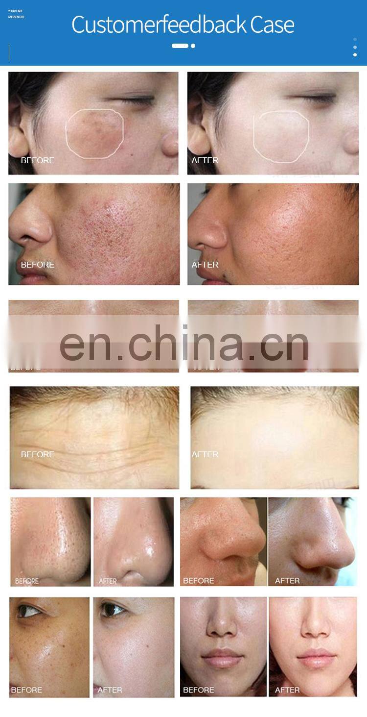 Multifunction 7 in 1 Professional Facial Deep Cleaning Diamond Oxygen Jet Peeling Microdermabrasion Machine