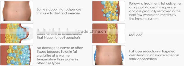 Nubway cryotherapy portable cryo machine