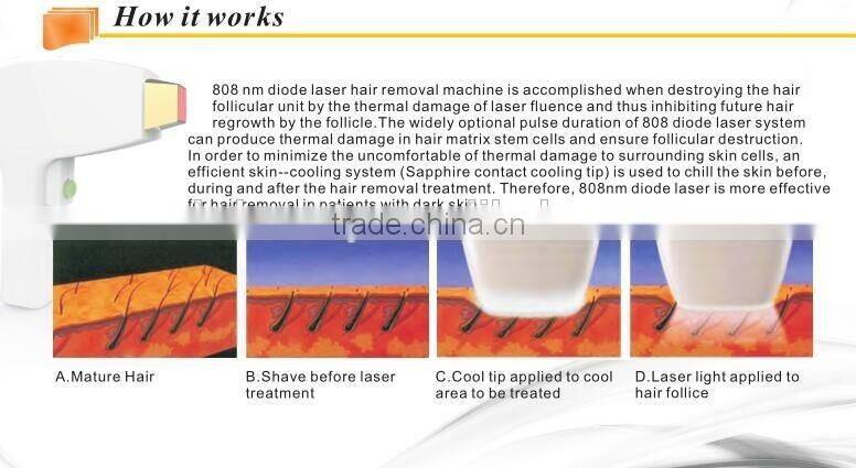 Professional 808nm Hair Removal Machine with CE