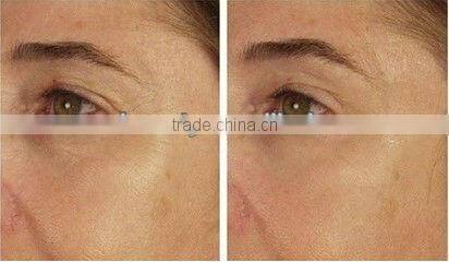 2013Newest IPL technology hair removal never shave or wax again