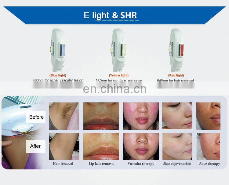 2019 laser machine opt SHR e-light permanently hair removal
