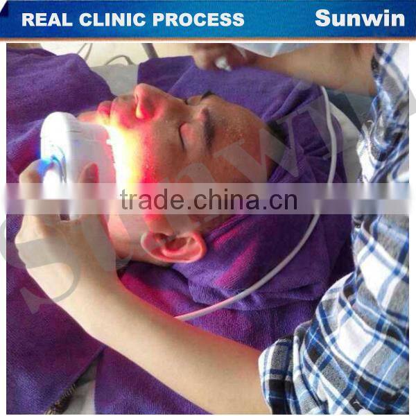 hifu for skin tightining beauty machine SW-131B