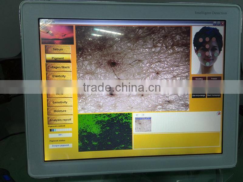 Professional English skin analysis software skin analyzer