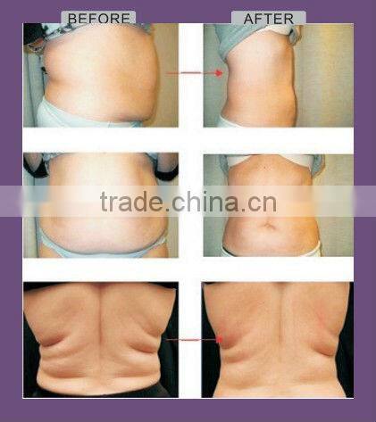 Hot 2013! lipo laser beauty machine Max 130mW beauty machine Max 130mW CE/ISO