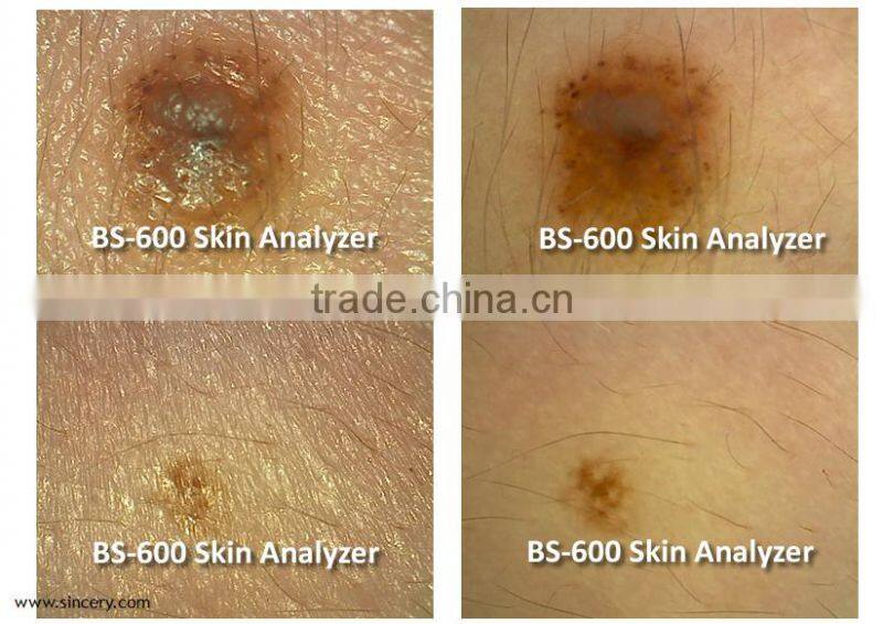 Portable high quality skin scanner/Mini skin and hair scanner