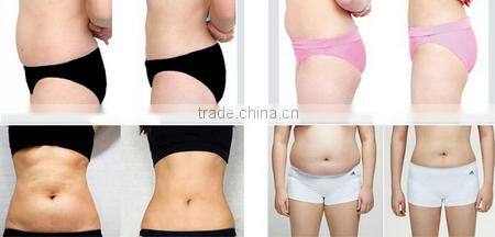 hifu machine for wrinkle removal body slimming