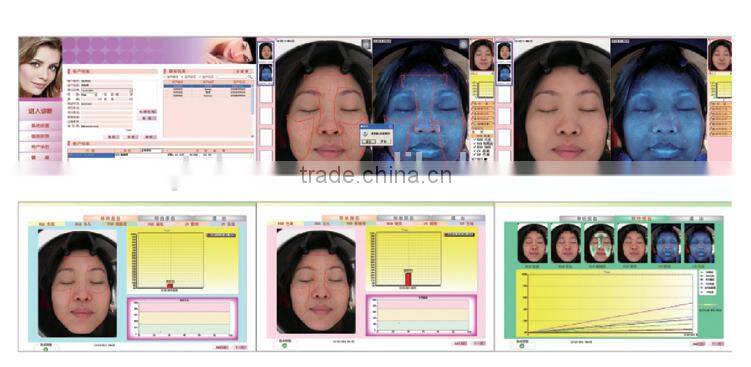 full body health analyzer skin analysis system optical retinal camera