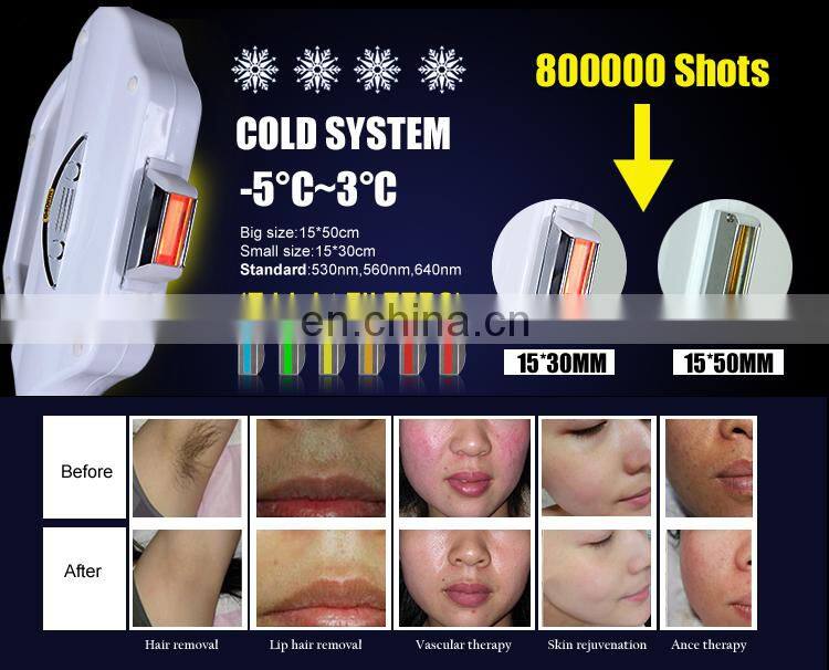 Acne removal ipl hair removal machine shr elight+rf skin lifting machine