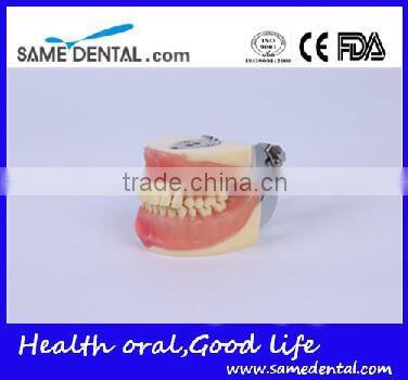 Dental Surgical Integrated Model Teaching Demonstration Teeth Model