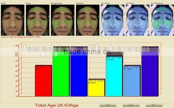 professional 3D facial skin analysis device with CE