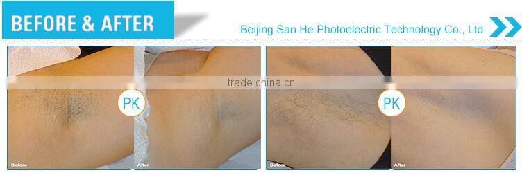 e-light IPL laser hair removal machine SHR function