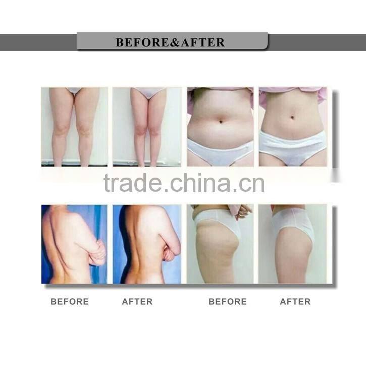 Vacuum Ultrasonic Cavitation Machine