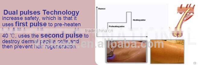 808nm permanent hair removal device depilation laser home