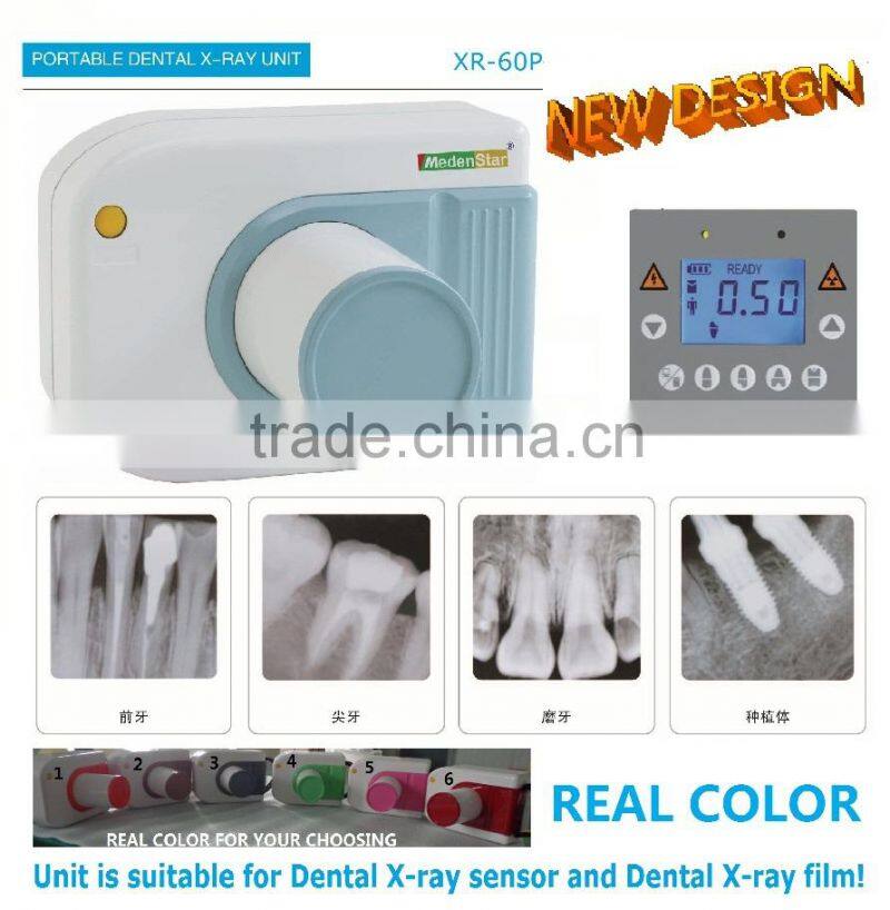 Portable Dental X-Ray Unit