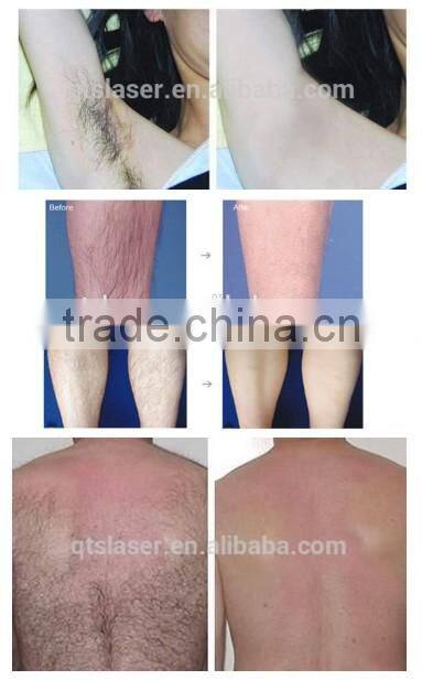 Professional beauty equipment factory/hair removal machine factory