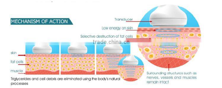 fast slimming Focused ultrasound body slimming system ultrasonic mach cellulite reduce body shaper slimming machine