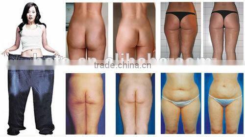 Guangzhou HETA Cryo + RF Ultrasonic Cavitation fat freeze slimming machine