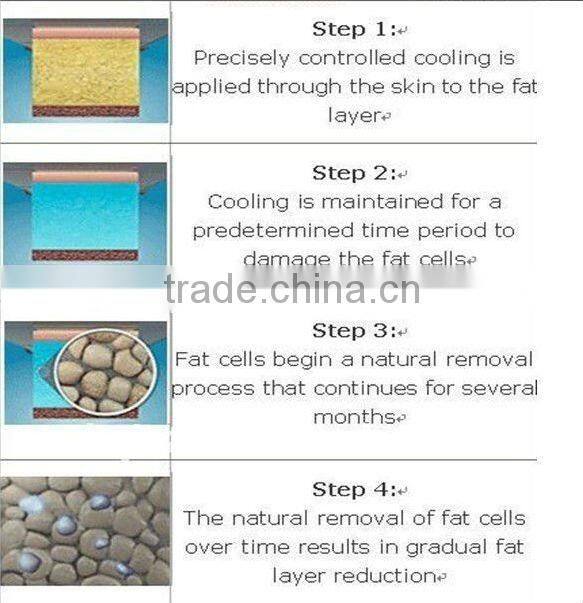 Chinese supplier wholesales 4 handles cryolipolysis machine