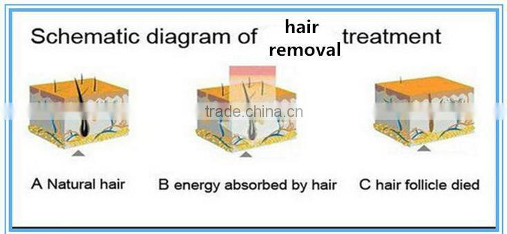 elite ipl shr laser hair removal machine for sale