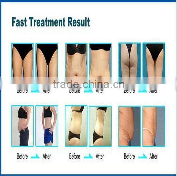BZ06 New designed portable RF ulstronic cavitation slimming machine