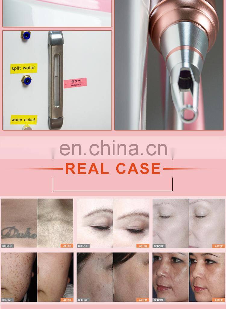 Multifunctional 3 in 1 pico laser/shr/rf machine for both tattoo removal and hair removal
