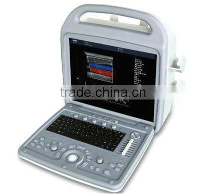 3D Color Doppler with Convex Probe with CE proved
