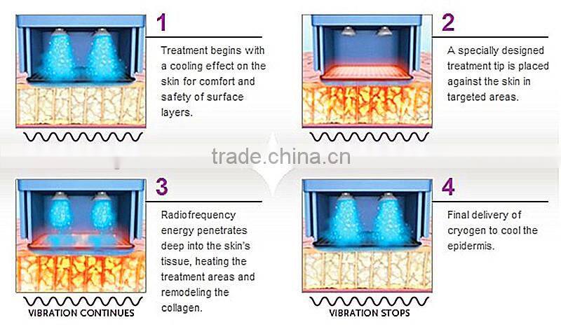 Advanced high quality professional fractional radio frequency