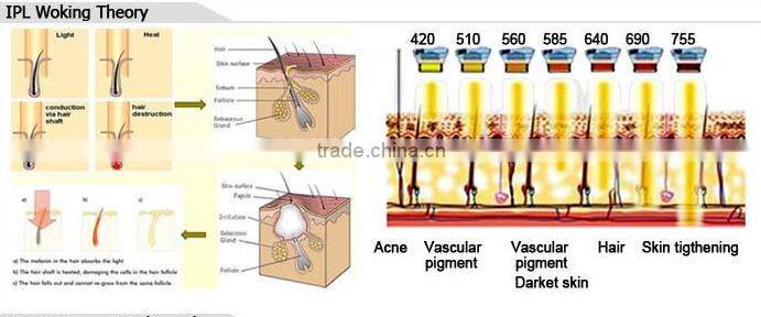 E6 2016 painless IPL/E-light laser hair removal machine