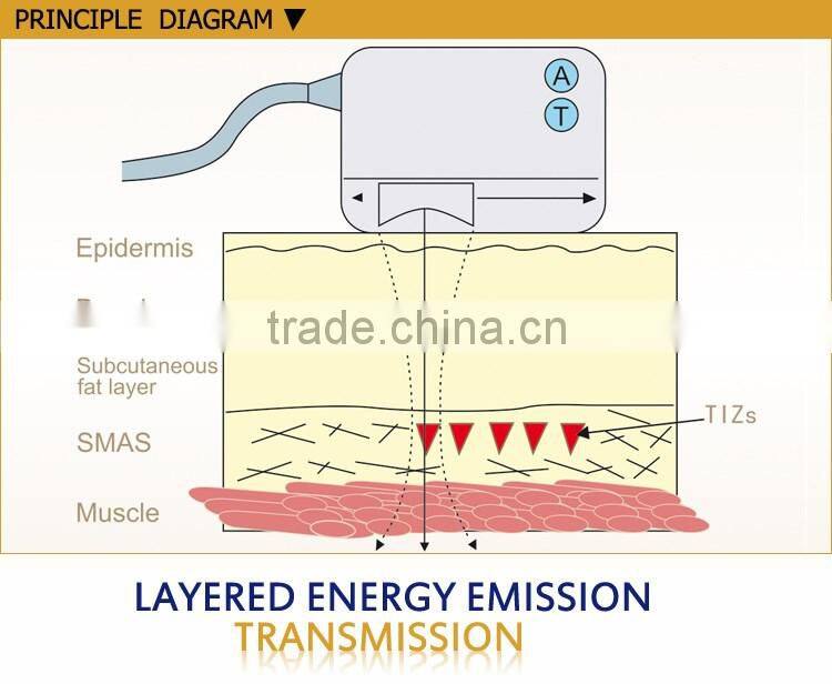 2016 ultrasonic smas system hifu body body and face treatment