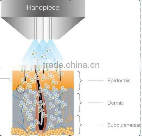NL-SPA13 Mini water dermabrasion machine for sale Skin Rejuvention Vacuum for sale
