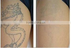 No side effective & safety using nd yag q switch laser tattoo removal machine/laser beauty equipment with Lowest price -D006