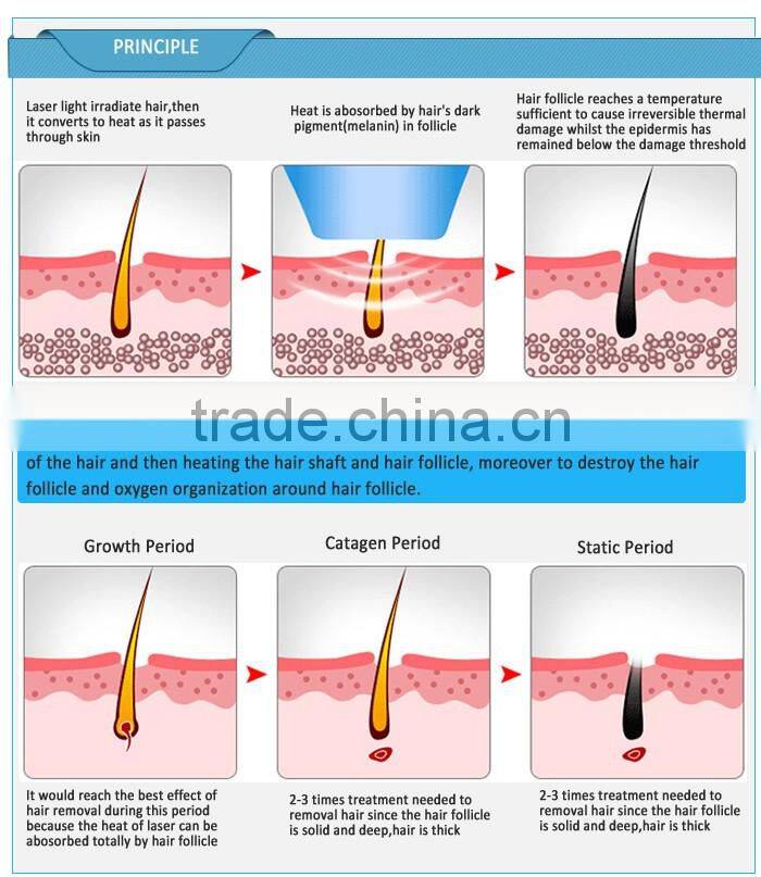 Beauty Salon Hot Sale 2015 Summer Home Use Portable Permanent Laser IPL Photon Hair Removal Epilator Machine