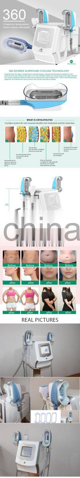 Oman 360 Cryolipolysis Cryotherapy Body Slimming Cryo Machine Fat Freezing 360 Cryolipolyse Cryo