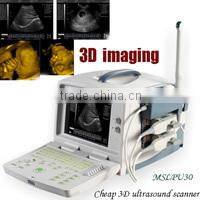 Coupon available! Ipad ultrasound scanner, touch screen scanner 3D color doppler MSLCU22-N