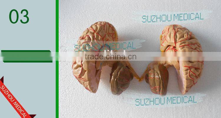 Distribution of brain and cerebral arteries