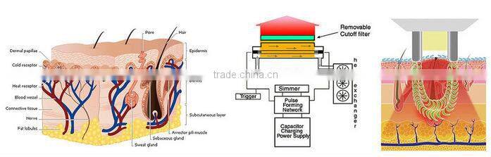 Golden Manufacturer fda approved ipl laser machine e light ipl rf system