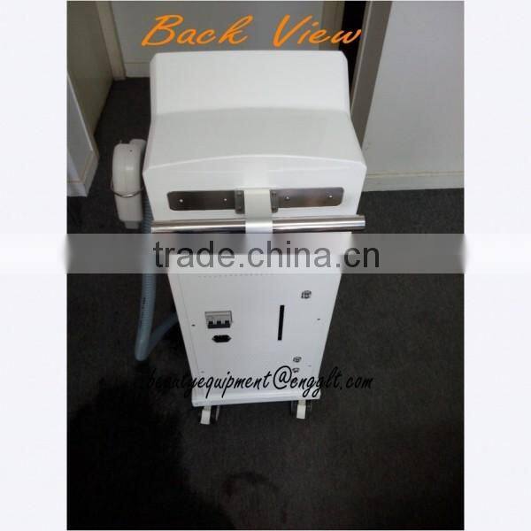 nice epilator diode laser