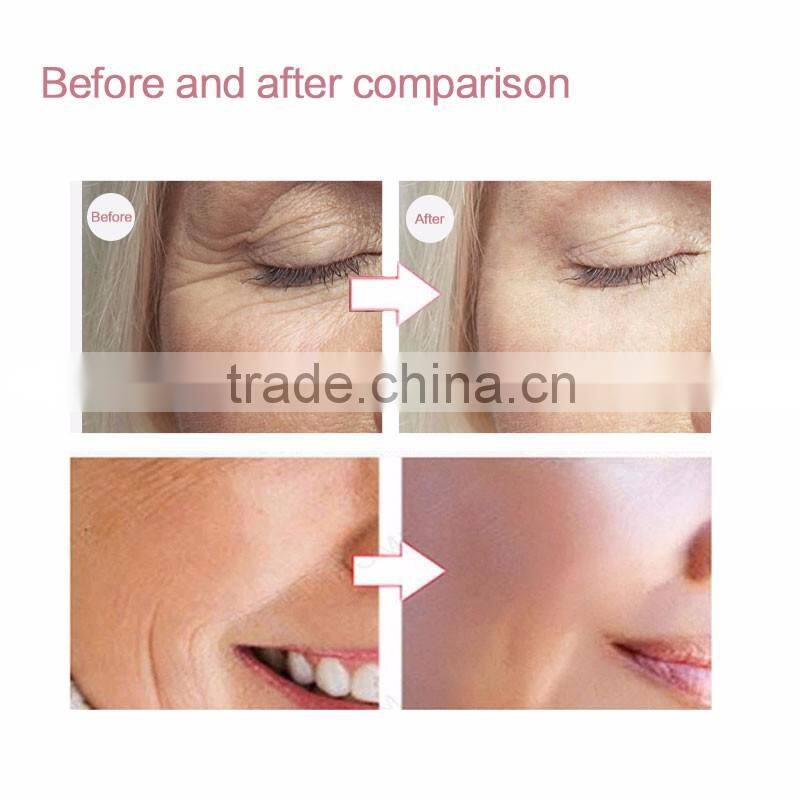 Top skin care products hot and cold beauty device facial massager for lady