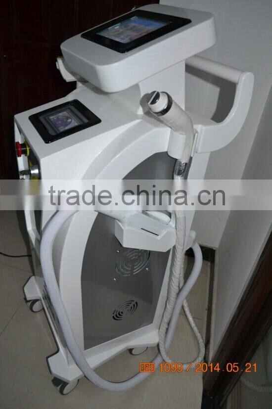 elight rf ipl na yag laser machine