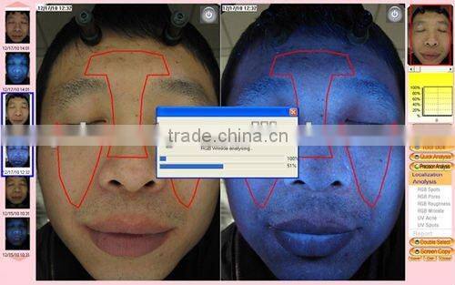 WT-01-S Portable Magic Mirror skin diagnosis system