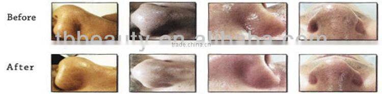 2016 Best Professional 7 in 1 spa PDT light therapy diamond dermabrasion machine with oxygen jet peeling, water oxygen peeling