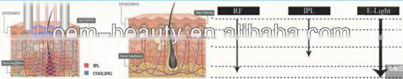 2016 new ipl hair removal &skin rejuvenation beauty machine for IPL beauty salon use
