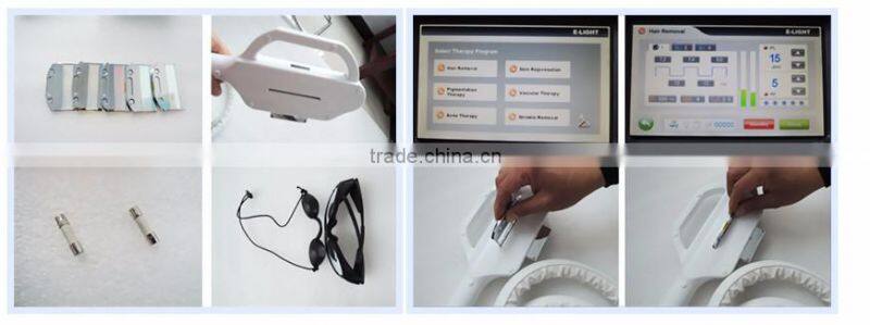 2017 Hot best ipl home machine elight ipl hair removal skin rejuvenation ipl rf