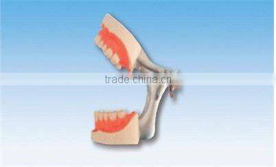 pathology Transparent teeth model