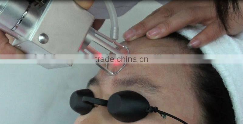 professional co2 laser RF tube price for scar removal and skin resurfacing laser