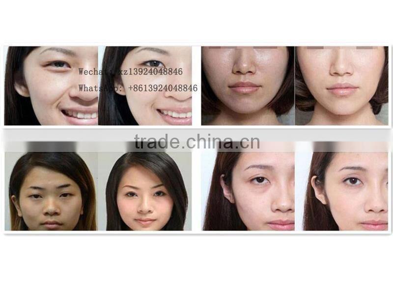 Meso skin rejuvenation meso mesotherapy injection gun korea/portable needle free mesotherapy gun for sale