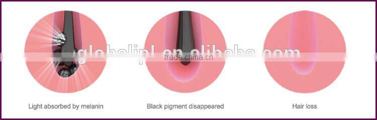 Hot sale painless beard hair removal 808 nm diode laser depilacion machine