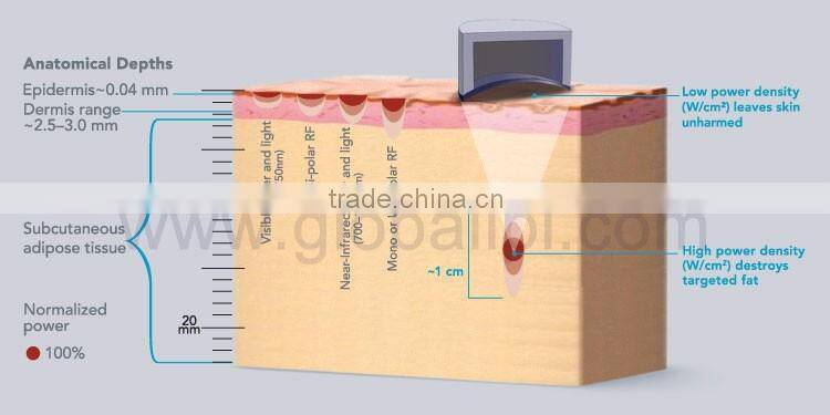 hot shaping machineultrasonic blackhead remover cellulite reduction liposonix