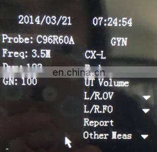 HC-A003 Cheap Full digital laptop veterinary ultrasound scanner machine